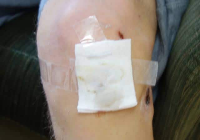 bandage-sellotape-knee