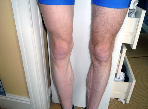 pic shaved man Leg